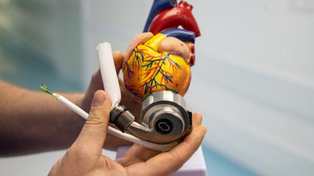 Стаття В Александровской больнице Киева впервые провели операцию по имплантации механического сердца Ранкове місто. Одеса