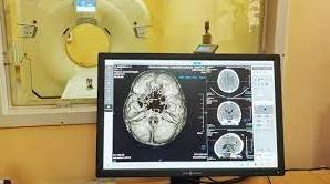 Стаття В дитячій лікарні Одеси встановили комп’ютерний томограф (фото) Ранкове місто. Одеса