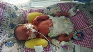 Стаття Одеські медики врятували життя двом немовлям вагою менше кілограма (фото) Ранкове місто. Одеса